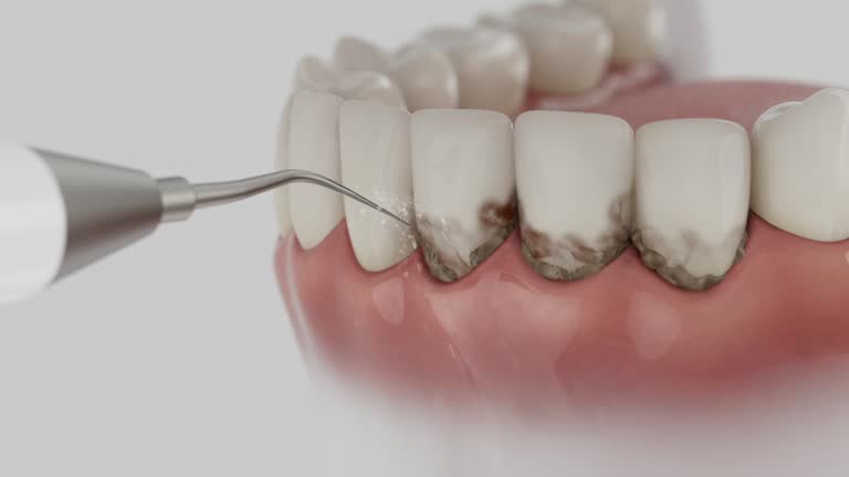 Trusted Teeth Cleaning And Checkup service in Forest Meadows, CA - Dentist Open Now
